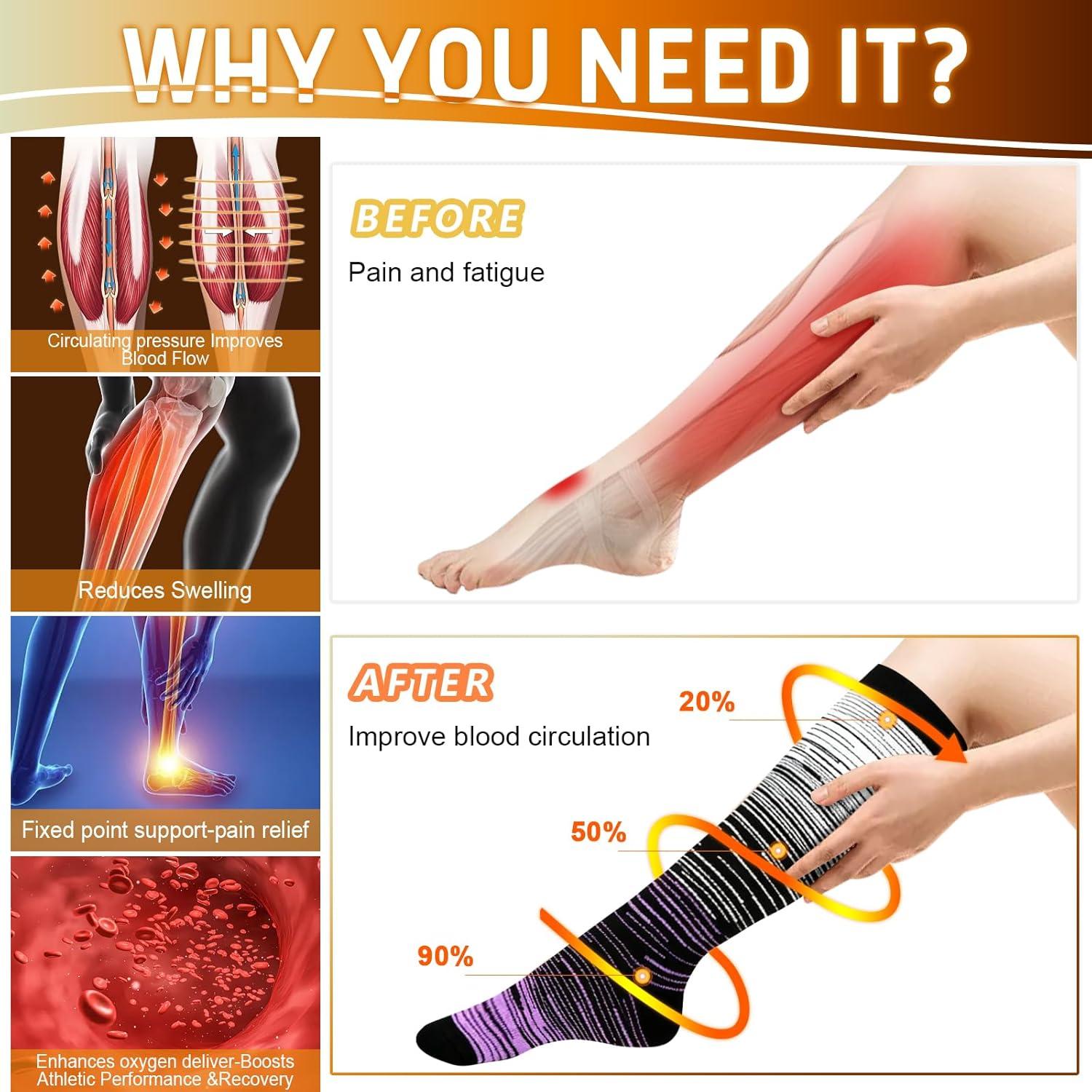 image:imageGraduated Compression Socks for WomenampMen 2030mmhg Knee High Socks Travel Hiking Running Stocking055 Pairs Multi Stripe 03