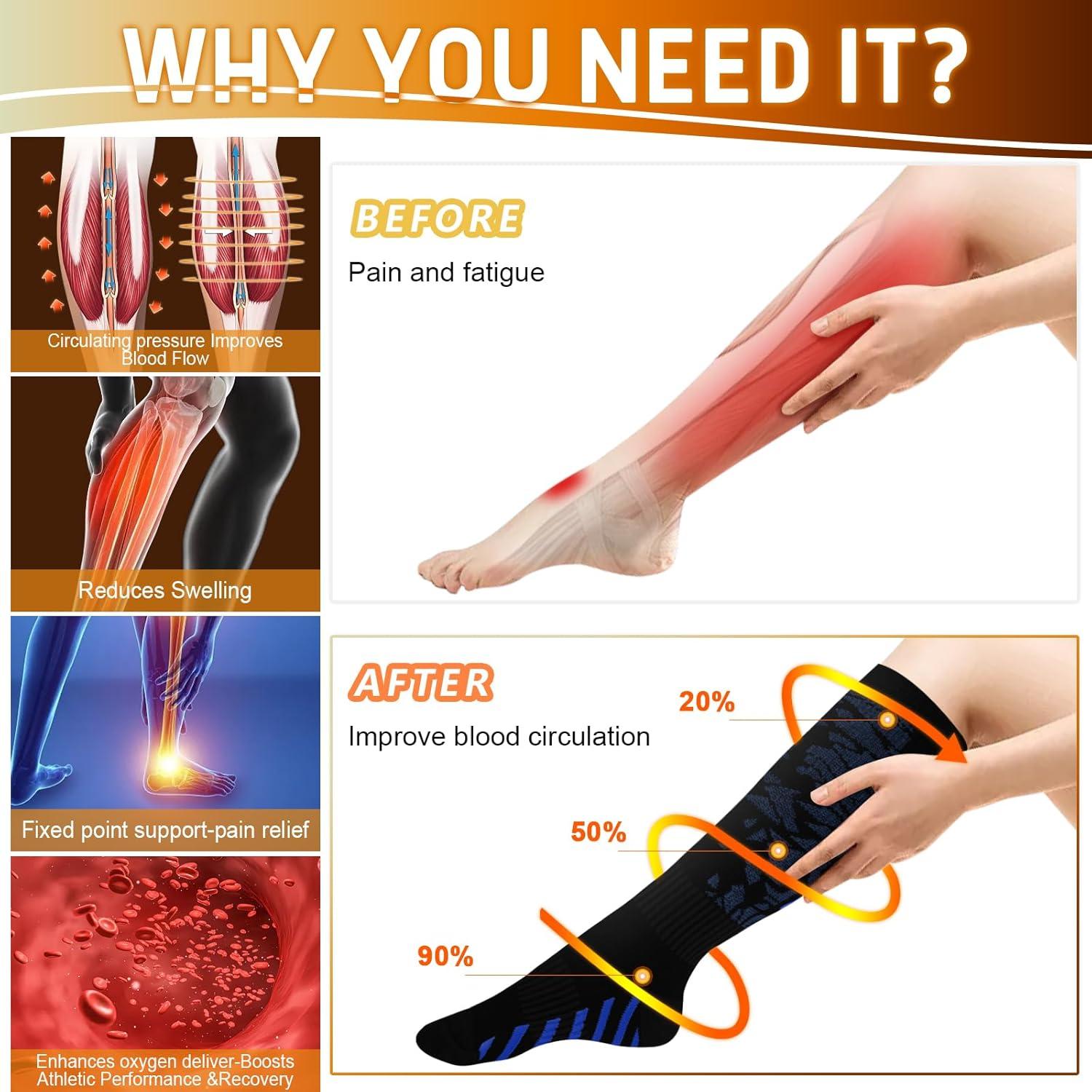 image:imageGraduated Compression Socks for WomenampMen 2030mmhg Knee High Socks Travel Hiking Running Stocking066 Pairs Multi Stripe 02