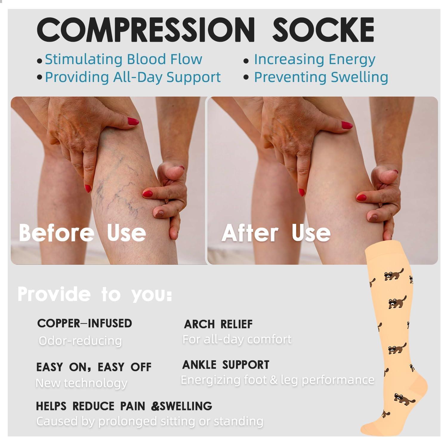 image:imageGraduated Compression Socks for WomenampMen 2030mmhg Knee High Socks Travel Hiking Running Stocking126 Pairs Animal Series01