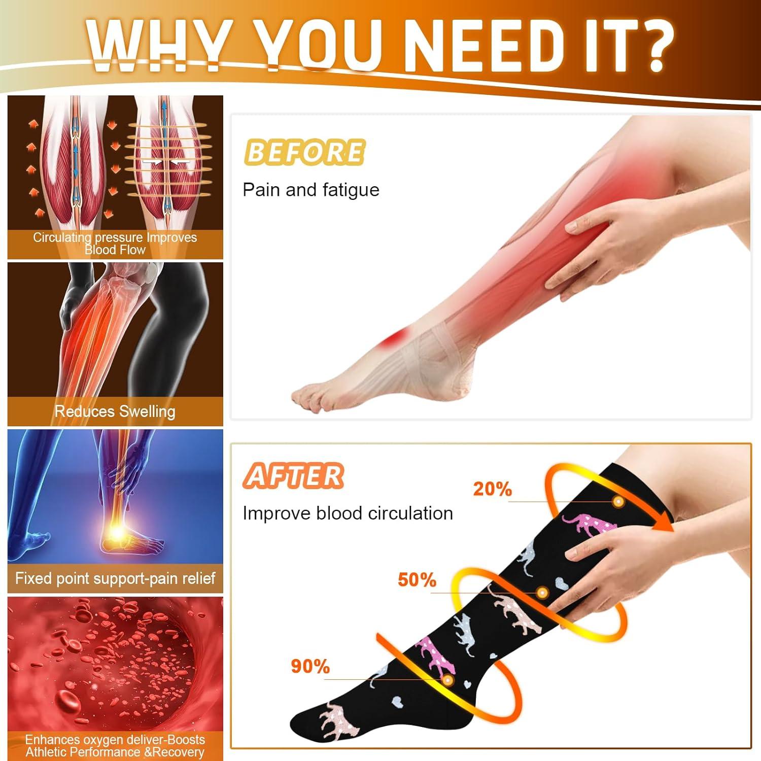 image:imageGraduated Compression Socks for WomenampMen 2030mmhg Knee High Socks Travel Hiking Running Stocking126 Pairs Animal Series02